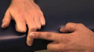 Image result for Elson Extensor Tendon Test