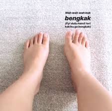 Kaki bengkak saat hamil memang sering terjadi pada ibu hamil. 6 Solusi Mengatasi Kaki Bengkak Saat Hamil Dan 4 Penyabnya Jangan Minum Obat Pelancar Kencing Semua Halaman Grid Health