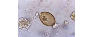 Diphyllobothrium In The Past Review And New Records Sciencedirect