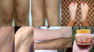 Melanin is a pigment in the skin that scientists need to do more research to investigate effective ways to lighten dark knees. Pin On Amazing