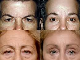 P Emmett Hurley Md Ms Plastic Surgery Hurley Emmett
