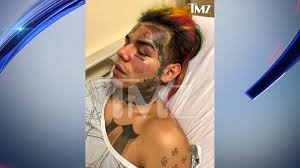 Daniel hernandez (born may 8, 1996), known professionally as tekashi69 or 6ix9ine (pronounced six nine), is an american rapper, and songwriter. Rapper Tekashi 6ix9ine Tells Cops He Was Pistol Whipped And Robbed In Brooklyn Won T File Report Nypd