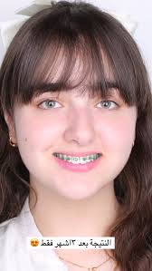 Dr.Sarab Ali_د.سراب علي‎ (@dr.sarab.ali) • Instagram photos and videos