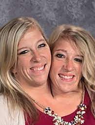 But very few actually share a body part, and even fewer share a single body. Abby And Brittany Hensel See What The Famous Conjoined Twins Look Like Today Conjoined Twins Oprah Winfrey Show Human Oddities