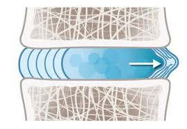 Image result for vyhřezlá ploténka