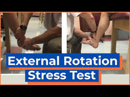 Image result for Ankle External Rotation Test