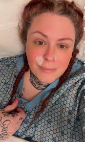 Week post op gallbladder removal 🙏🙏🙏🙏 What are u guys eating please