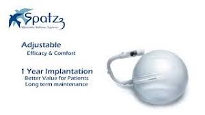 بالون الرشاقة سباتز الأمريكي Glance At Spatz Intra Gastric Balloon Youtube