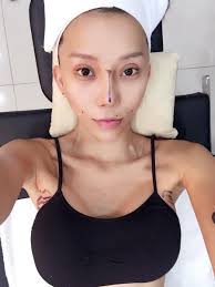 We broke up yesterday before my surgery u said u wanted to move home and say i treat u like a dog and say i. 16 Shocking Photos Of This Malaysian Dj Who Underwent Plastic Surgery