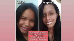 Fundraiser by Lisauri Ulloa espinal : Trasplante de médula ósea