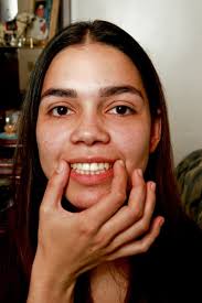 Serviço ortodôntico de má qualidade rende reparação