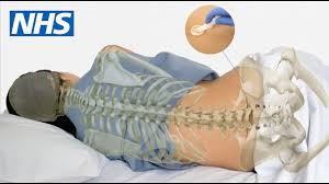 Image result for Bone Marrow Exam