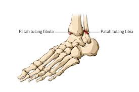 Belajar mengumpan (passing) kaki bagian dalam. Serangan Dengan Tendangan Dengan Menggunakan Kaki Yaitu Pada Kaki Bagian 7 Teknik Tendangan Taekwondo Yang Wajib Di Kuasai Tendangan Ini Menggunakan Kekuatan Paha Dan Betis Bilbalaza
