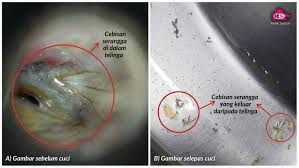 Maybe you would like to learn more about one of these? Telinga Klinik Sabah