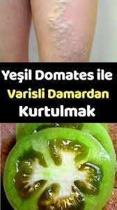Bu Numara Ile Varisli Damarlarinizdan Kolayca Kurtulabilirsiniz Bunu Bilmiyordun Saglikli Yasam Tarzi Dogal Saglik Herboloji