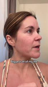 Desesperación por un gran grano: ¡Ayuda!