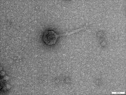 Starting with manfred von ardenne, early attempts were reported of the examination of specimens inside environmental cells with water or atmospheric gas, in conjunction with conventional and scanning transmission types of electron microscopes. Transmission Electron Microscope Tem With Edx Detector