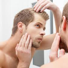 Cela vous aidera à mieux connaître la nature de ses cheveux et les. Calvitie Doctissimo