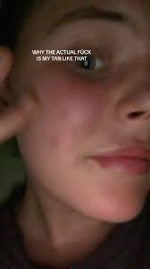 WHY ARE THERE DOTS ON MY FACE #tan #faketan #tanning #tangonewrong #help  #fyp #foryou