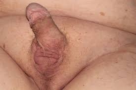 Castration penectomy porn - 72 photo