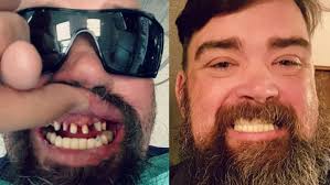 Dave Stock beat cancer twice but faces a $10,000 dental bill