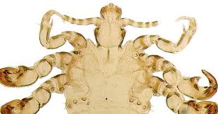How to check yourself for pubic lice. Pubic Lice Still Not Going Extinct Wired