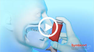 Inhaled formoterol fumarate dihydrate bp acts locally in the lungs as a bronchodilator. How To Use Symbicort Budesonide Formoterol Fumarate Dihydrate Inhalation Aerosol Inhaler Pharmacology Being Used