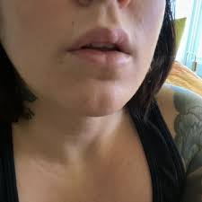 Rapid decrease in lung cancer and mela. San Francisco Institute Of Aesthetic And Regenerative Medicine 18 Reviews Medical Spas 421 Post St San Francisco Ca Phone Number Yelp
