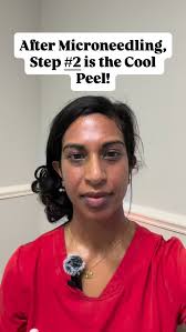 Step #2 in our Trifecta facial is the Cool Peel! This 5% TCA peel travels  into the dermis to accelerate the production of new collagen. #esthetician  #roswellga #medspa #atlantabeauty @environskincare ...