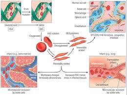 Maybe you would like to learn more about one of these? Diagnose Und Behandlung Von Sichelzellanamie Test Health Life Media