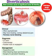 Rosh Review Rectal Bleeding Medical Pictures Colonoscopy