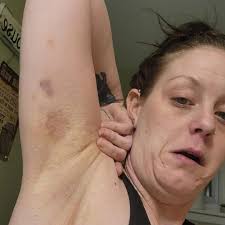 Oakley Strong❤️🌻 (@oakleystrongtree)