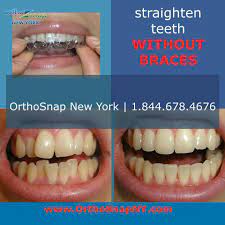 Orthosnap Is The Very Latest System For Teeth Straightening Without Braces It S Quick Easy T Teeth Straightening Clear Braces Straighten Teeth Without Braces