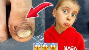 😱 Melissa s-a LOVIT PUTERNIC la UNGHIE 😭