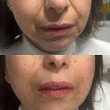 MarySophiaaesthetics