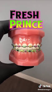 Pin By Heather I Follow Back On Teeth Braces Audrey In 2020 Dental Braces Colors Getting Braces Braces Teeth Colors