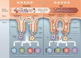 Microbial Signatures Of A Healthy Gut And Ibd Under Healthy Download Scientific Diagram