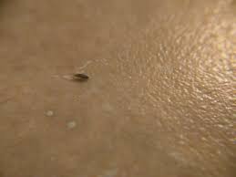 Find solutions to your tiny tiny bugs question. Super Tiny Bugs In Kitchen 336478 Ask Extension