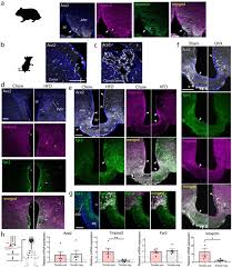 Select a picture on your computer or phone, specify the desired size in kilobytes, megabytes or percentages and then click ok button at the bottom of this page. The Hypothalamus As A Hub For Sars Cov 2 Brain Infection And Pathogenesis Biorxiv
