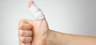 The prognosis also depends on various factors, such as if there is an. Broken Finger Treatment And Recovery