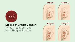 Image result for Breast Cancer