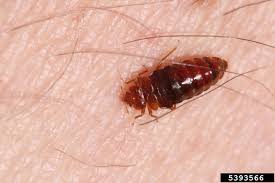 Image result for Cimex lectularius bites