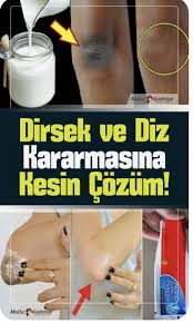 Dirsek Kararmasini Geciren Etkili Yontem Cilt Bakimi Cilt Bakimi Dogal Guzellik Ipuclari Vucut Bakimi