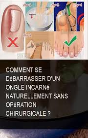 Pin On Astuce Sante