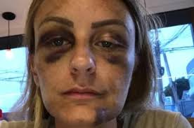 Quem é a ex-jogadora de vôlei que bateu com uma coleira em um entregador no  Rio de Janeiro