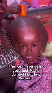 What Disability Does Littlemann17 Havetext=this Is A Question Ithat I Am  Short Stature