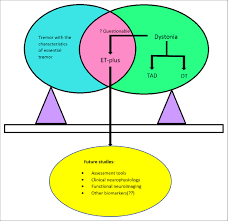 Image result for Essential Tremor