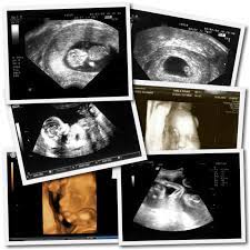 Es+4, ganz starkes gefühl, schwanger zu sein. Woran Erkenne Ich Ob Ich Schwanger Bin Tipps Fur Eltern Eltern Familie Baby Kind Und Meer
