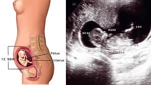 Sie sind schwanger und möchten wissen, ab dem wievielten monat man ihren babybauch sieht? Entwicklung Embryo Fotus Grossen Tabelle Bilder Hallo Eltern