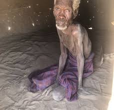Very thin and weak, usually because of illness or extreme hunger: Image Of Emaciated Kenyan Claimed To Be Man Jailed By Ousted Sudanese President Omar Al Bashir The Observer
